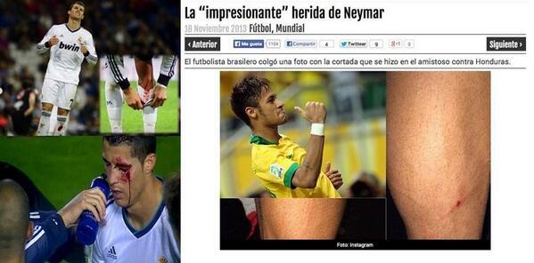 ReaI_Madrid_CF's tweet photo. A Cr7 le hacen heridas de verdad sigue luchando y marcando goles.
Neymar llora por esta pequeña herida.

#Diferencias http://t.co/PqhuzBegiG