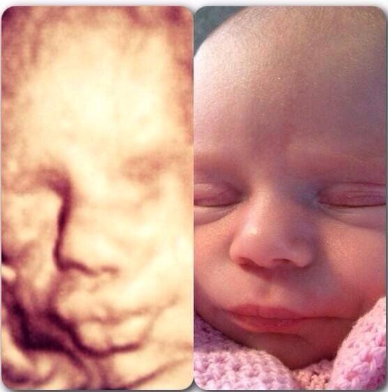 Pearl_baby_scan's tweet image. Amazing likeness before and after ! A beautiful baby girl xx #3dbabyscan #wirral