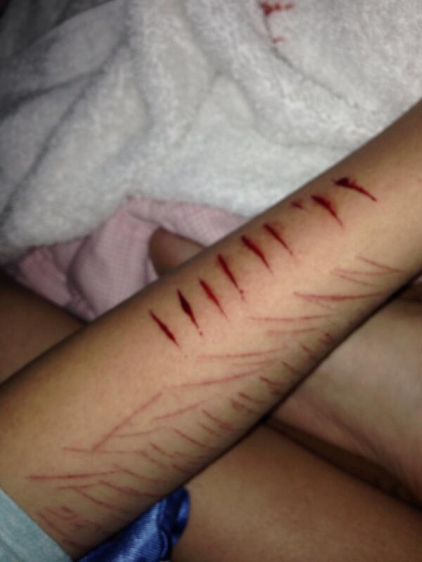 brokeninside20's tweet image. The difference in my normal everyday cuts to what I started doing now 😭😭 my arm is numb