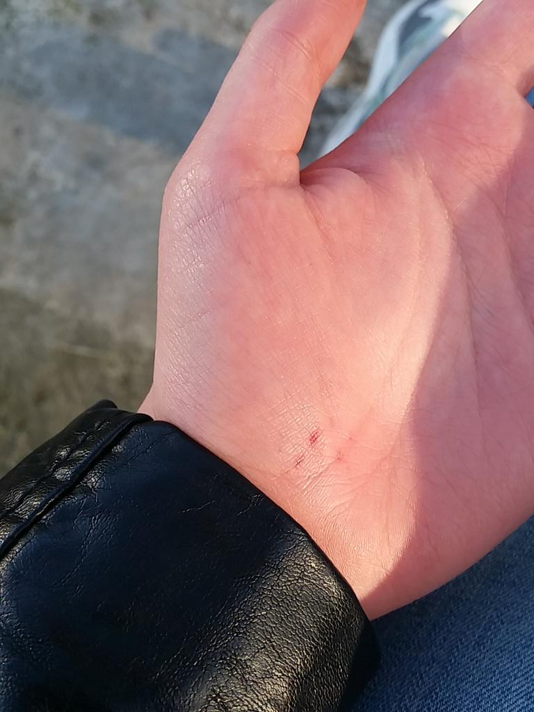 fluffyhcurl's tweet photo. #longboardunfall auaaa http://t.co/ksfHGe4q7e