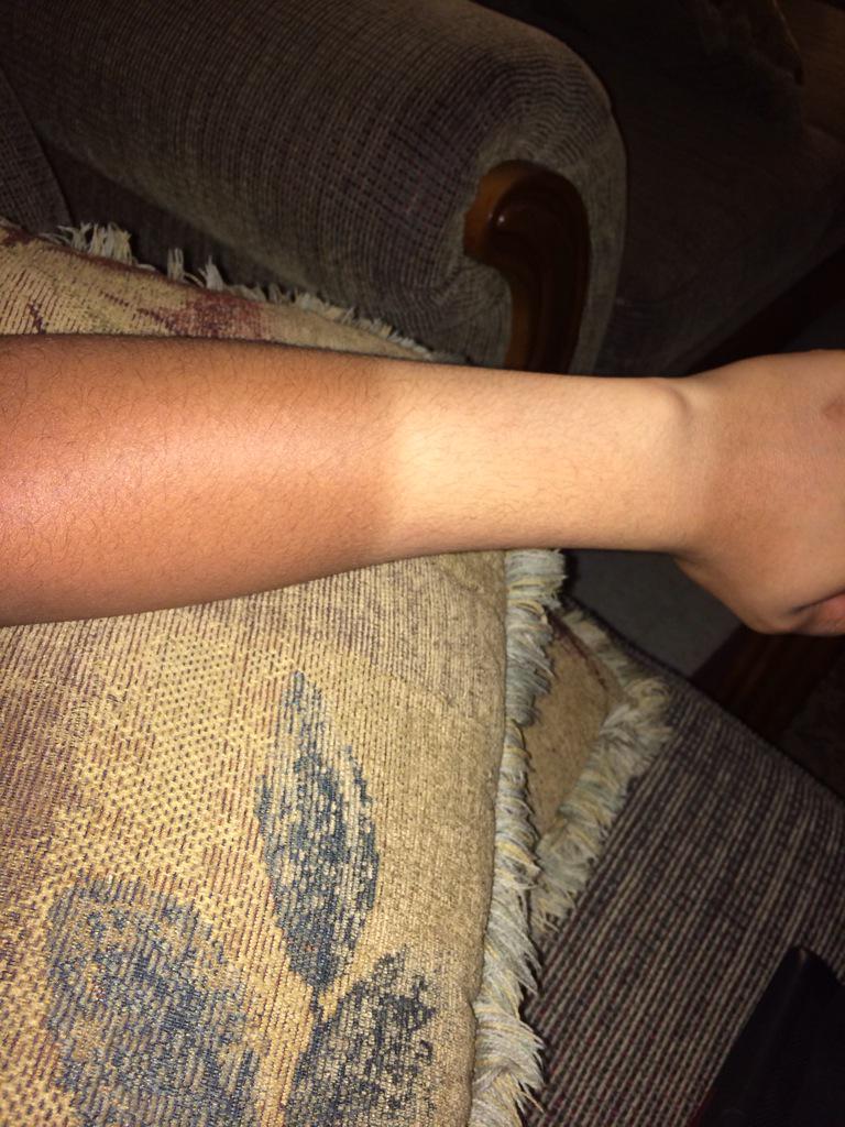 JasonLuis2's tweet photo. Thanks a lot @EvoShield π #thetanisReal http://t.co/DhN2vI3xOg