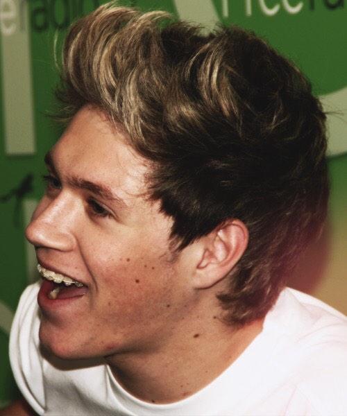 appreciationjh's tweet photo. NIALL'S FRECKLES APPRECIATION TWEET http://t.co/7uTlLu0meR