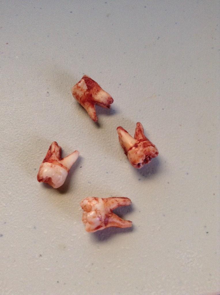 Defaultzzz's tweet photo. @MoXee_inT big ass teeth http://t.co/BmH2aguydy