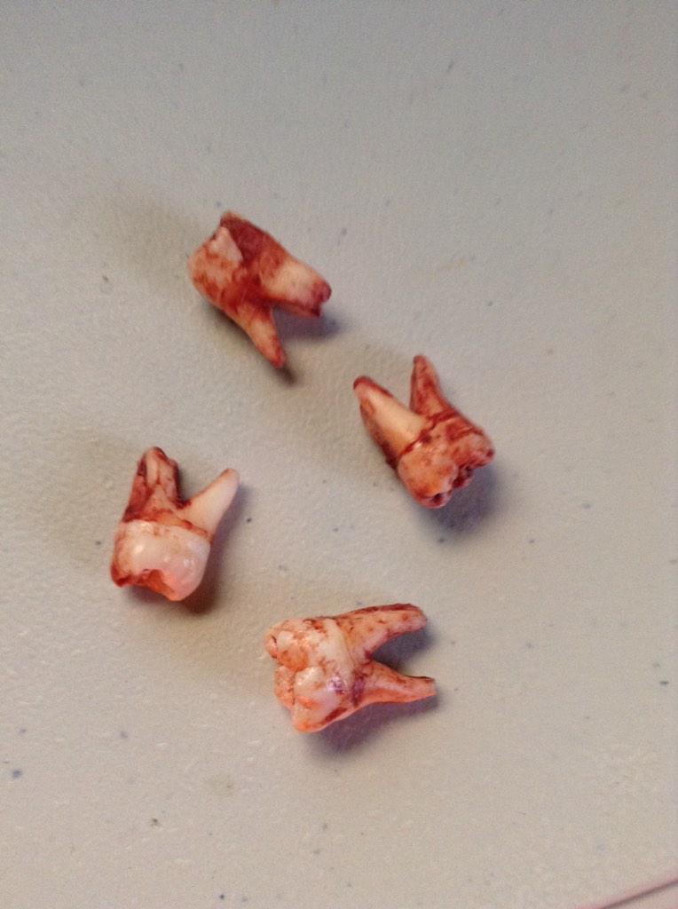 Defaultzzz's tweet photo. @Tormented_oB   Big ass teeth http://t.co/jCUde69w3y