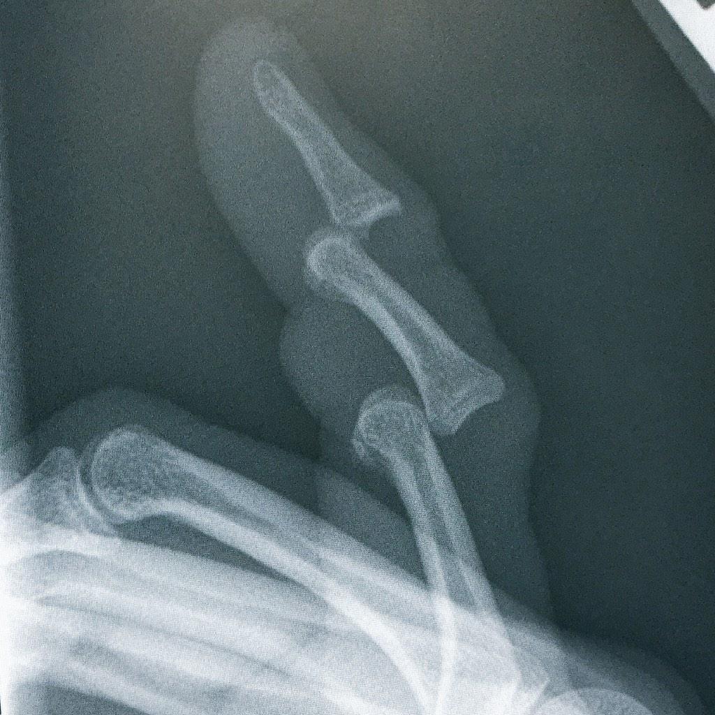 EM_Tips's tweet image. Don't have to be a board certified ER physician to see what's wrong here ...