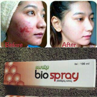 Vimala BioSprayGOLD tweet media