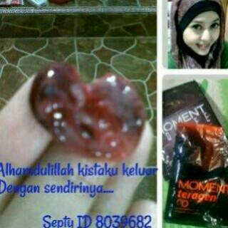 Zak4rias's tweet photo. Atasi bopeng / bekas jerawat, flek hitam, kulit kusam, Kista, myom dan keputihan dgn GLUCOGEN / TERAGEN. http://t.co/7ePJo5bDaQ