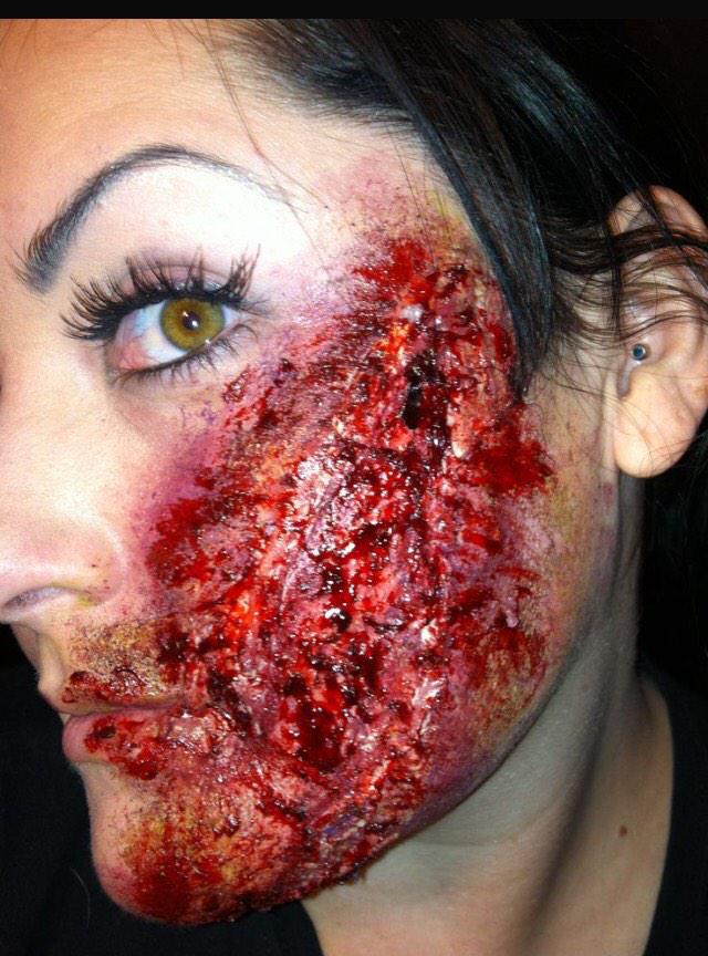 Crazy Injuries on Twitter: "Do I have anything on my face? http://t.co