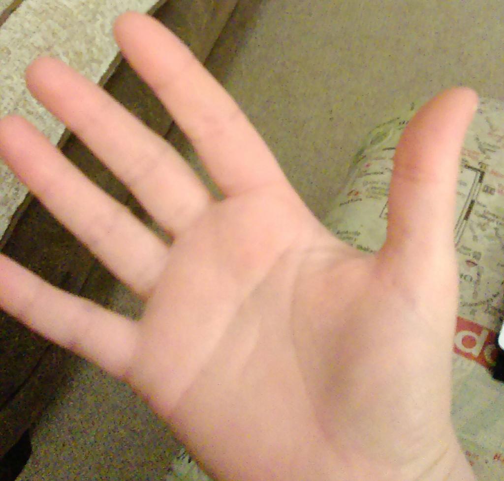 SarahKCowling's tweet photo. So this is a rare thing apparently...#simianline #right hand #female - feeling special. http://t.co/L1yiCFeG81