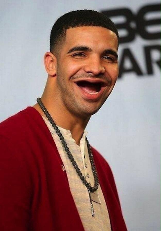 eeschmidty's tweet image. Drake with. No teeth @kaypynn