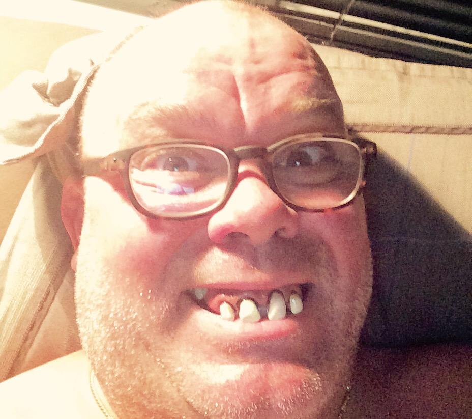 pauldeleeuw1962's tweet image. Ik werd vanmorgen wakker en dacht: moet de mondhygiëniste bellen