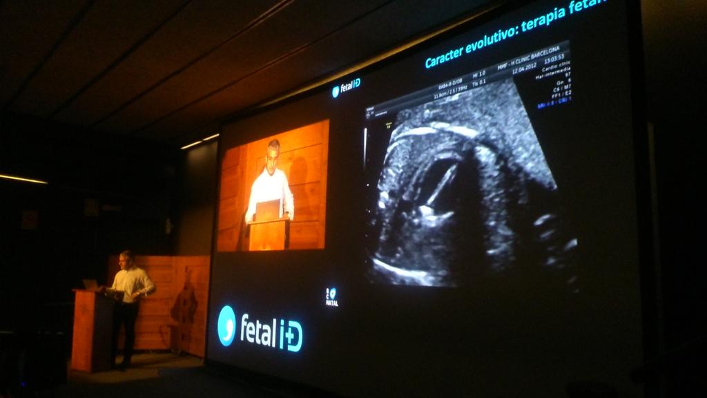 medfetalBCN's tweet photo. Dr. Martínez-Crespo mostrando valvuloplastia aórtica #cirugíafetal# #ecocardiografia #medicinafetal  #seva2015 http://t.co/gafob06TSD