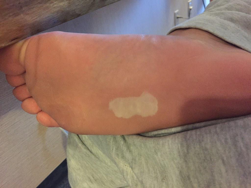 E7 81 Ab E5 E8 A1 Carian Twitter