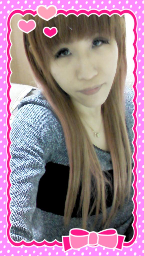 タァ Chan Auf Twitter 中途半端な二重が長年コンプレックスで 子供時代から両親にさえも 二重 の整形したいだなんて口が裂けても言えなかった 大人になったら いつか自分の良いタイミングでと決めていた 漸く念願が叶い 今日 見事な幅広パッチリ 二重に変身