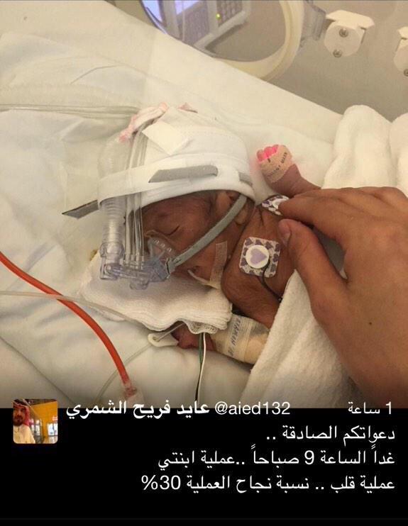 أو ل نيوز Twitterissa رجل يناشدكم الدعاء لإبنته التي ستدخل عملية جراحية في القلب خلال ساعات حيث نسبة نجاحها 30 فقط Http T Co Veyfxvkxkh