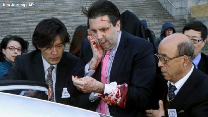 韓国駐在のアメリカ大使 刃物で襲われけが Togetter 韓国駐在のアメリカ大使 刃物で襲われけが Togetter