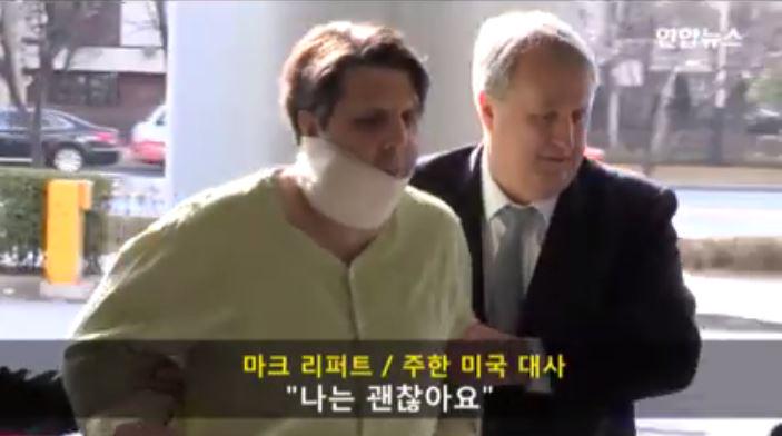 응급 치료 후 "나는 괜찮아요"라고 말하는 리퍼트 대사 i.wik.im/209786 by <a href="/A_DELA_KIM/">A_DELA</a> 환자복을 입은 채 턱에 붕대를 감은 대사. #미국대사