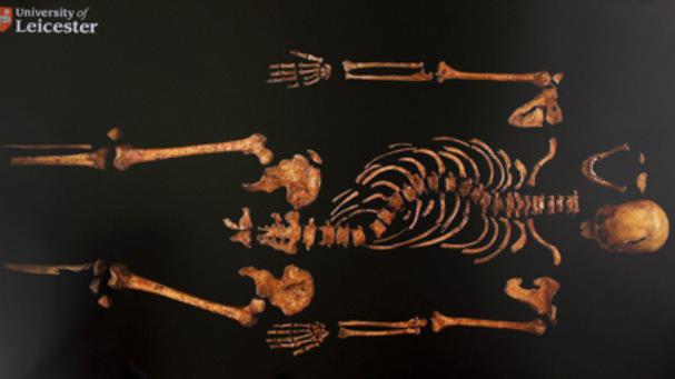 TheQueen123_'s tweet photo. @YoItsRichieIII you're even an ugly skeleton....#Yikes http://t.co/1fUdnL8NfZ
