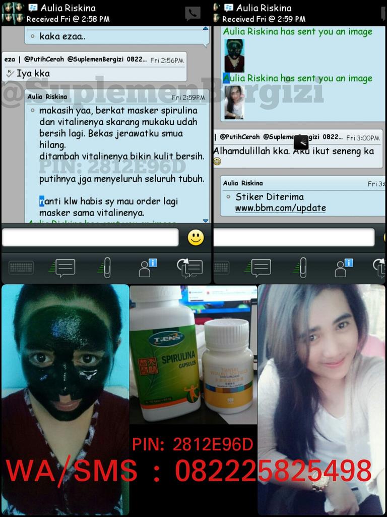 #testimoni ka <a href="/Riskinaaulia/">Aulia Riskina</a> berkat masker + vitaline bekas jerawat hilang. seluruh tubuh putih bersih. Pin: 2812E96D