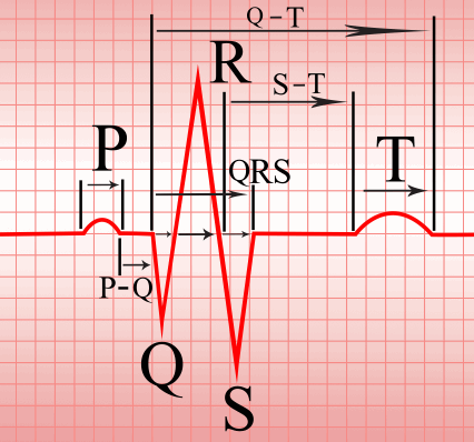 LearntheHeart's tweet photo. 10 Steps to Learn ECG Interpretation

From the http://t.co/qJblnU6CHn Cardiology Blog

http://t.co/vuTtPndVVw http://t.co/X0p2okbGNH