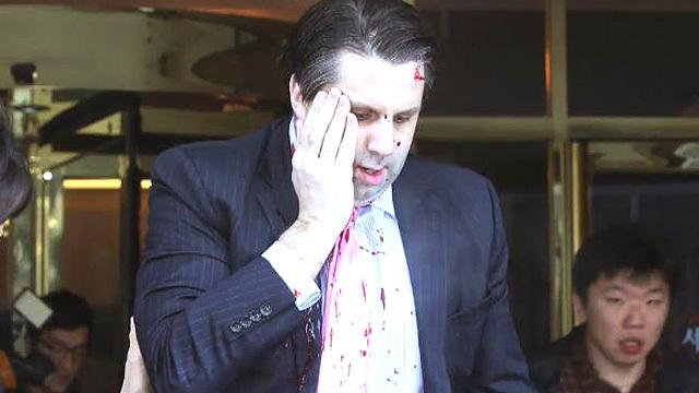 북한 조선중앙통신은 마크 리퍼트 주한 미국 대사가 흉기 습격을 당한 데 대해 남한 "민심의 반영"이자 "전쟁광 미국에 가해진 응당한 징벌"이라고 논평했습니다. news.sbs.co.kr/news/endPage.d…