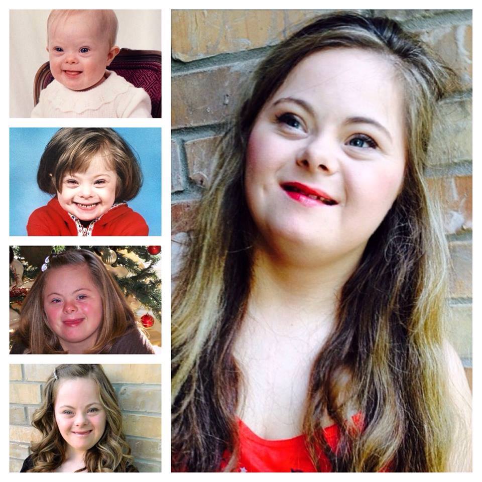 Ljepotica :) #beauty #downsyndroom #girl