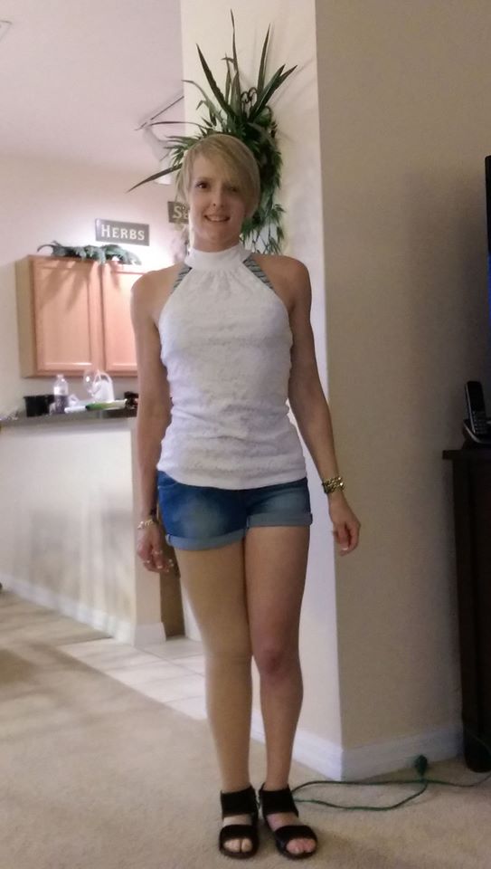 Jenny1984_hill's tweet image. MY ENTRY @ModsOfDiversity @ModsOfDiversUSA @GlobalDisabilit #disabledmodelcomp #lupus #smile #survivor #amputee