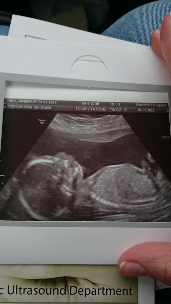 Kimberley Hall tweet media