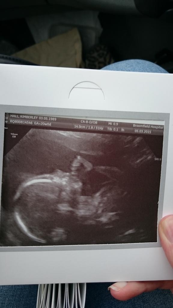 Kimberley Hall tweet media