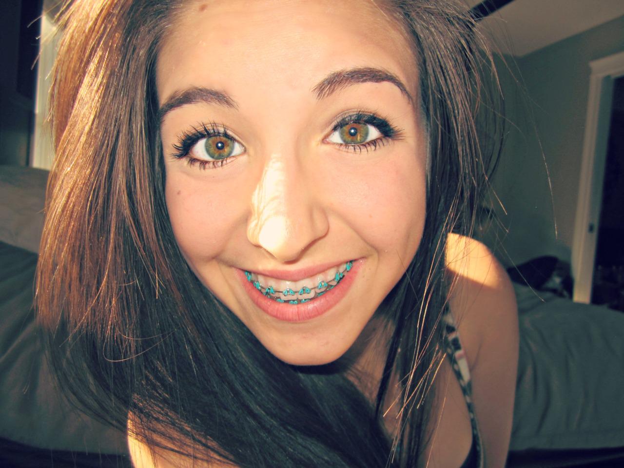 Girls With Braces On Twitter Check Out Her Cute Colored Braces 