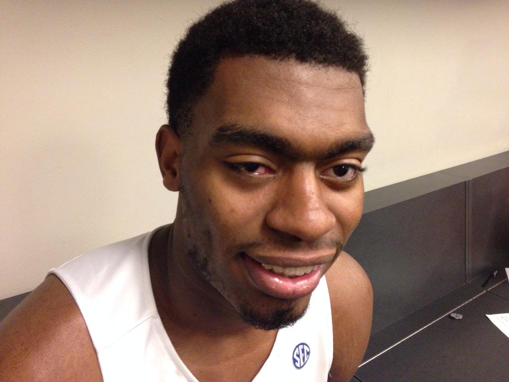Dakari Johnson is recovering from pinkeye Kentucky Sports Radio