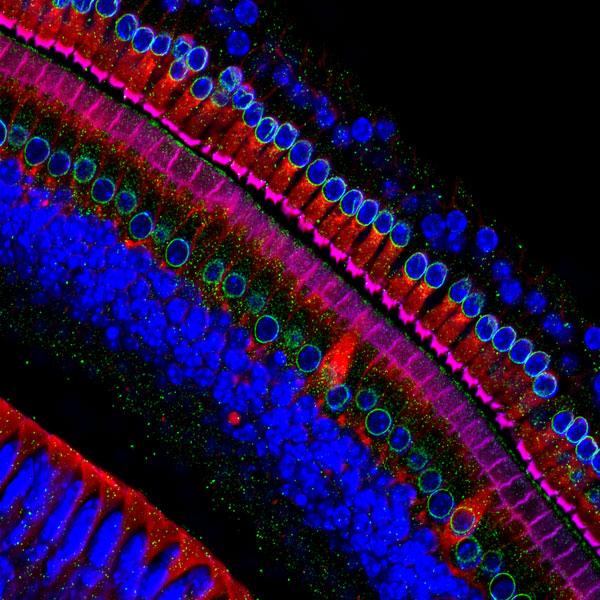 ASCBiology's tweet photo. Inner ear hair cells #SciArt by @astar_research #ASCBmember scientists http://t.co/IPX6vXpTCS http://t.co/XxAwLpmqep