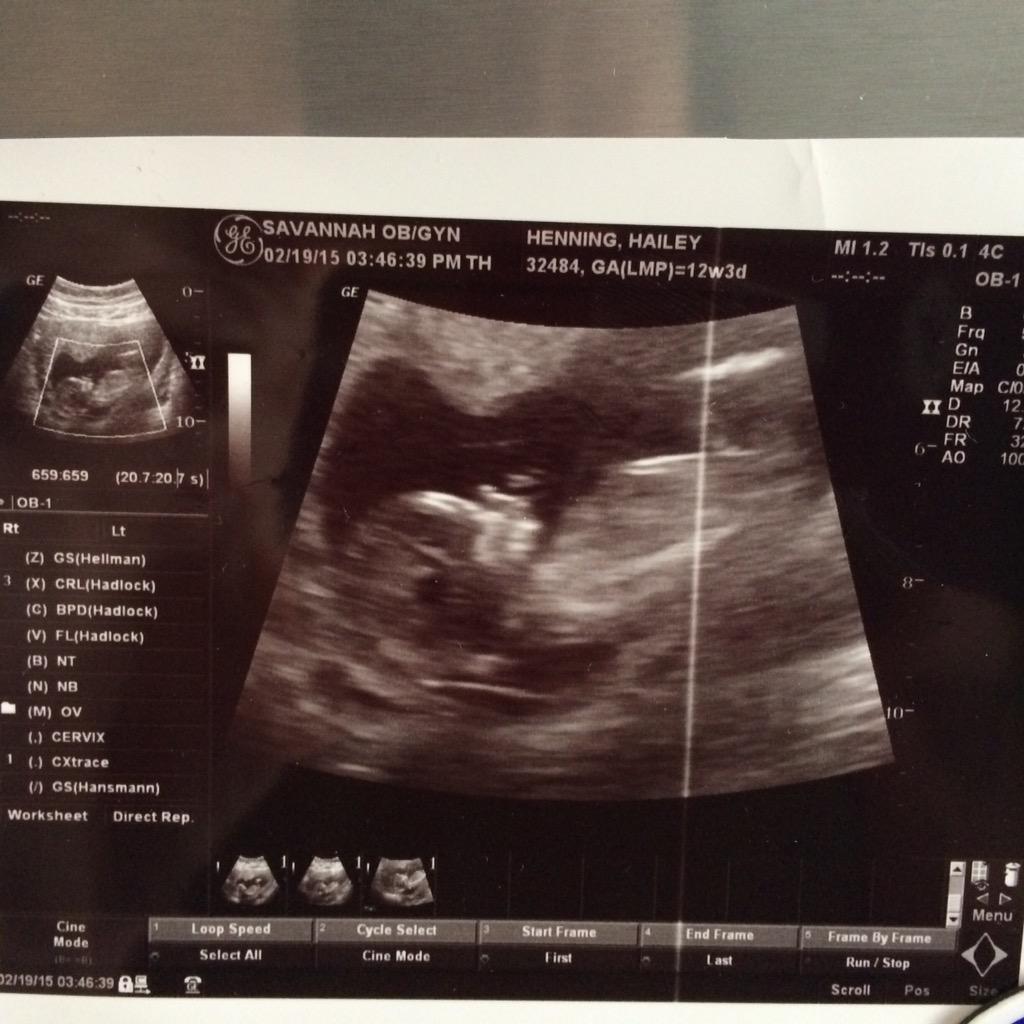 deltaleland's tweet photo. Life is beautiful...  Introducing my first grandchild!! http://t.co/hmgHyPBGeF