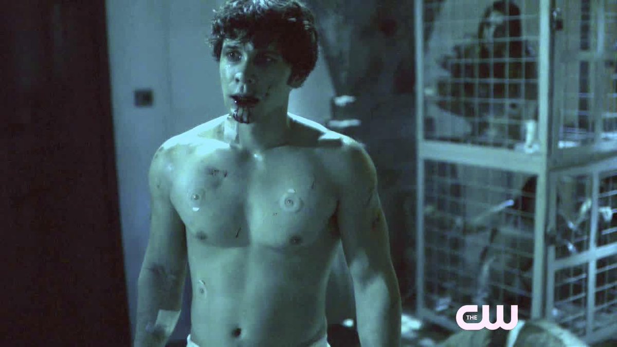 SeriesporMundo's tweet photo. #MomentosHot | Bob Morley (@WildpipM), Bellamy en #The100, en los capítulos 2x10 y 2x11. Más → http://t.co/6eq2itbGK4 http://t.co/6YYTPvZp4o