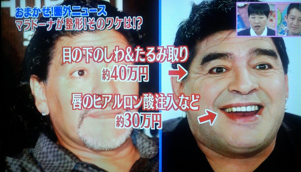 マラドーナの整形について高須クリニックの高須克弥先生がツイート Togetter