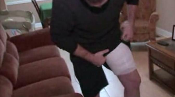 Pria Ini Alami Luka Bakar Serius Gara-gara Ponsel Meledak bit.ly/1E4Q8by