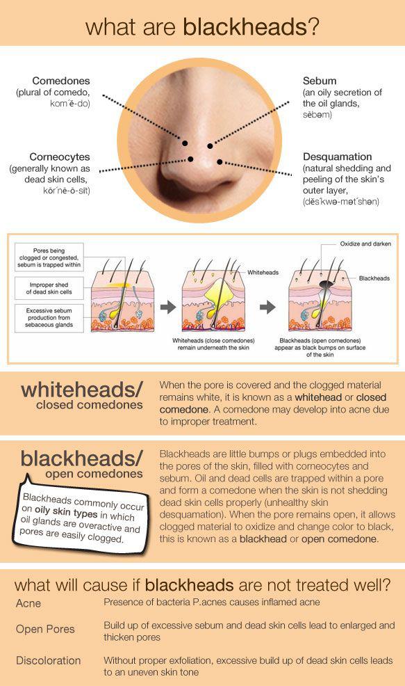 AcneSkinSite tweet picture