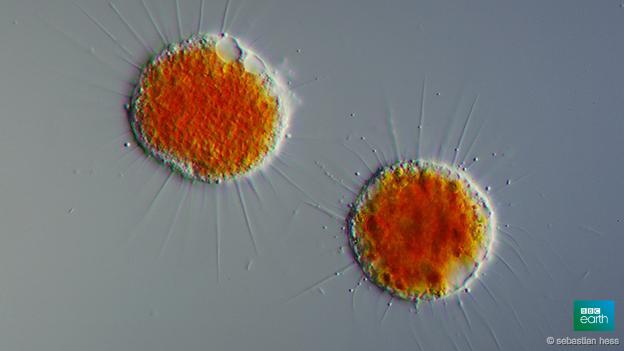 These microscopic vampire amoebas are everywhere bbc.in/1nVCd3l #vampyrellids