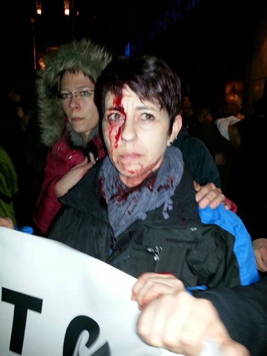 HenHoffgaard's tweet photo. #Pegida-Teilnehmerin in Frankfurt. 

Familienministerin Schwesig: "Linksextremismus ist ein aufgebauschtes Problem". http://t.co/FLiAC8LNc0