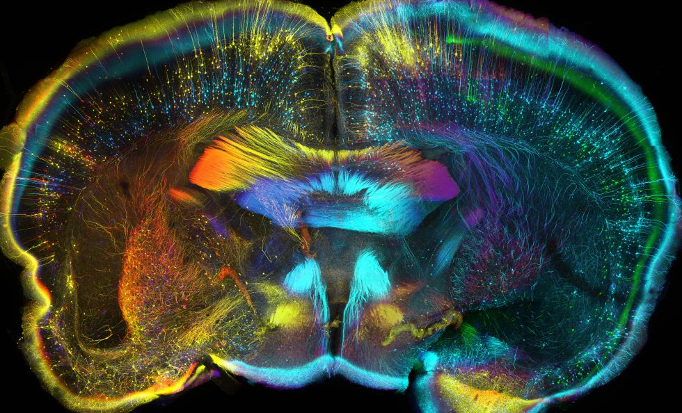 Colourful coronal view of a mouse brain vía <a href="/wellcomeimages/">Wellcome Images</a> psychedelic but true... ;)