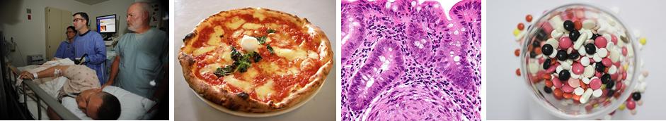 Autoimmun betegségek gyógyítása paleo-ketogén étrenddel. paleomedicina.com/hu/blog/2014/1…