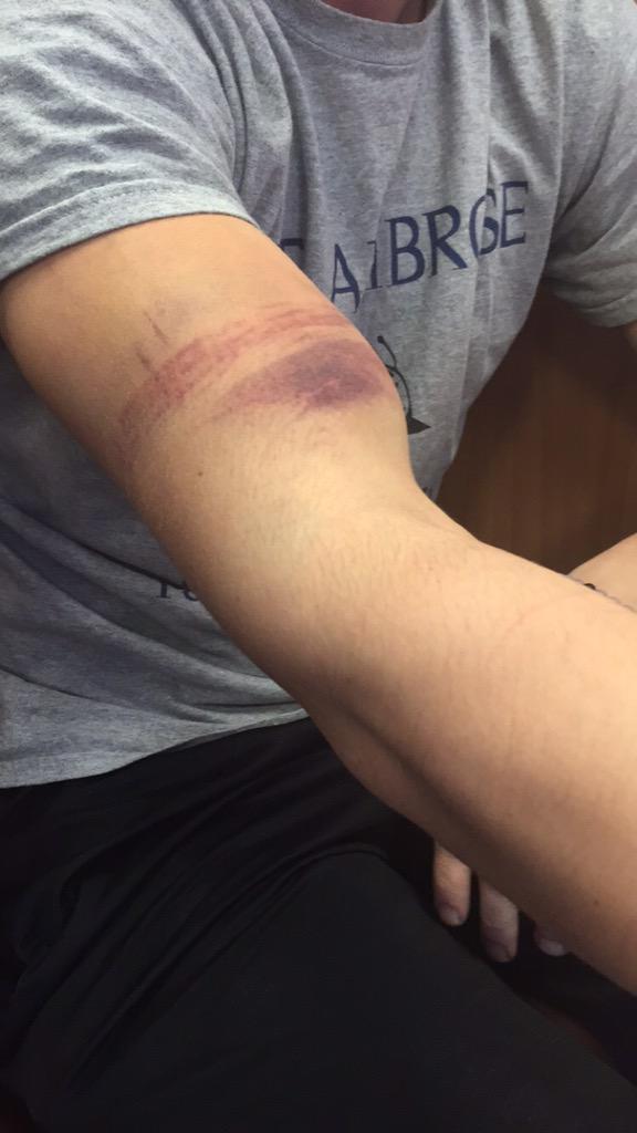 dan_tieman1's tweet photo. @AMaciag welcome to lacrosse #saulax http://t.co/SPRPQQrMkb