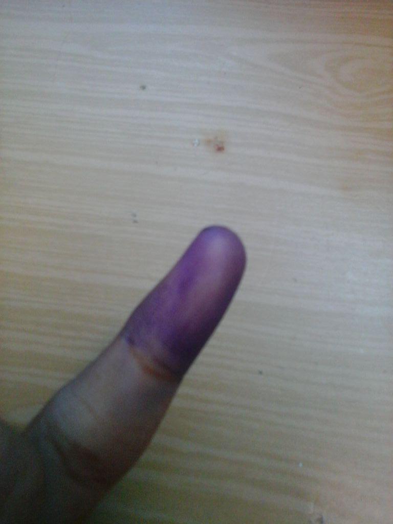 pemilwa_kbmsi's tweet photo. Ini jariku, mana jarimu?? @siub13 @SIUB2012 @SI_UB11 @emsi_ub @bpmsi_ub http://t.co/7zpEG2ujaX