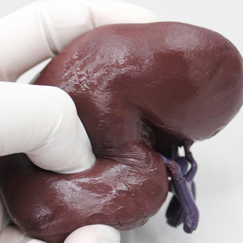 heresGiuseppe's tweet image. #3dprinting Enables Medical Models with Blood Guts, &amp;amp; All
3dprintingindustry.com/2015/03/10/3d-…
#lifelikeFeel #patientspecificmodels