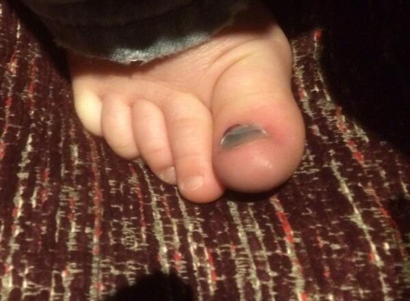 Harryship's tweet image. I dropped a bowling ball on my toe at @CP_UK_Elveden #owchie