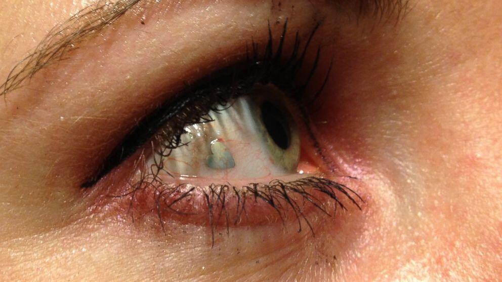 Sunny Hostin on Twitter "“ABC Surgically implanted eyeball jewelry