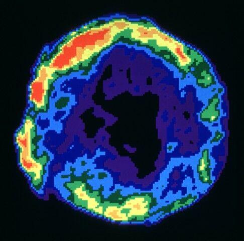 Cosmic "Sonic Boom" Brightens Tycho's Supernova --Its Light Reached Earth in 1572 dailygalaxy.com