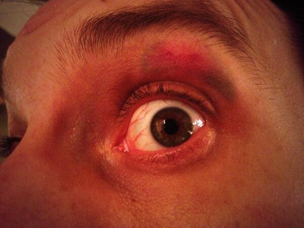 @steniakelsey kinda looks like eye make up