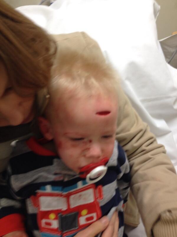 Dave_Giblin's tweet photo. Ice cream sandwich and 9 stitches and he was good to go! http://t.co/1lEghytcD6