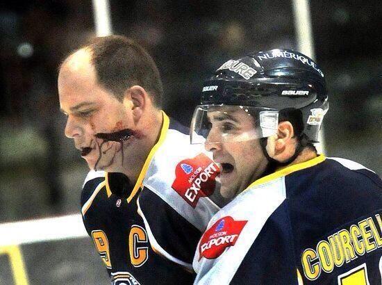 ChirpHard's tweet photo. Last night this guy took a skate to the face and yes, he skated off on his own. http://t.co/YKHMg0uyBD